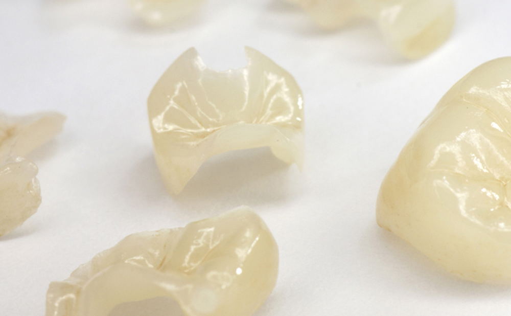 プレスセラミックス デンタルアート