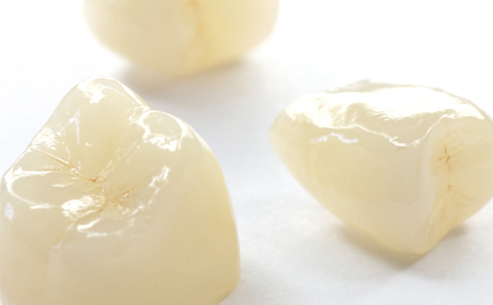 プレスセラミックス デンタルアート