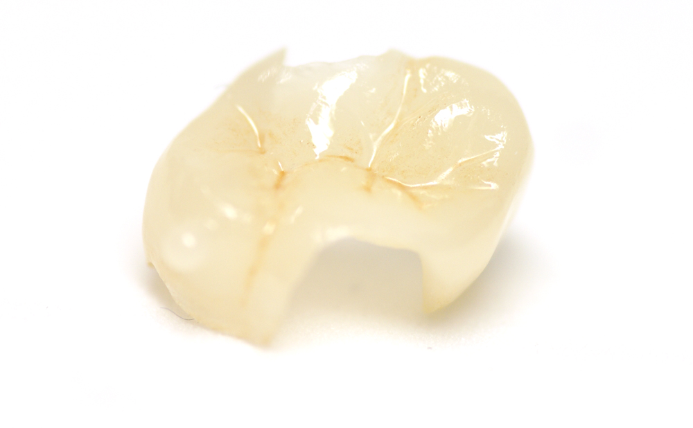 プレスセラミックス デンタルアート