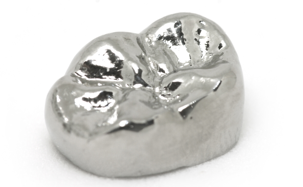 純チタンクラウン デンタルアート